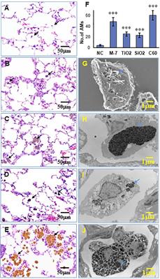 Surfactant Proteins A/D–CD14 on Alveolar Macrophages Is a Common Pathway Associated With Phagocytosis of Nanomaterials and Cytokine Production